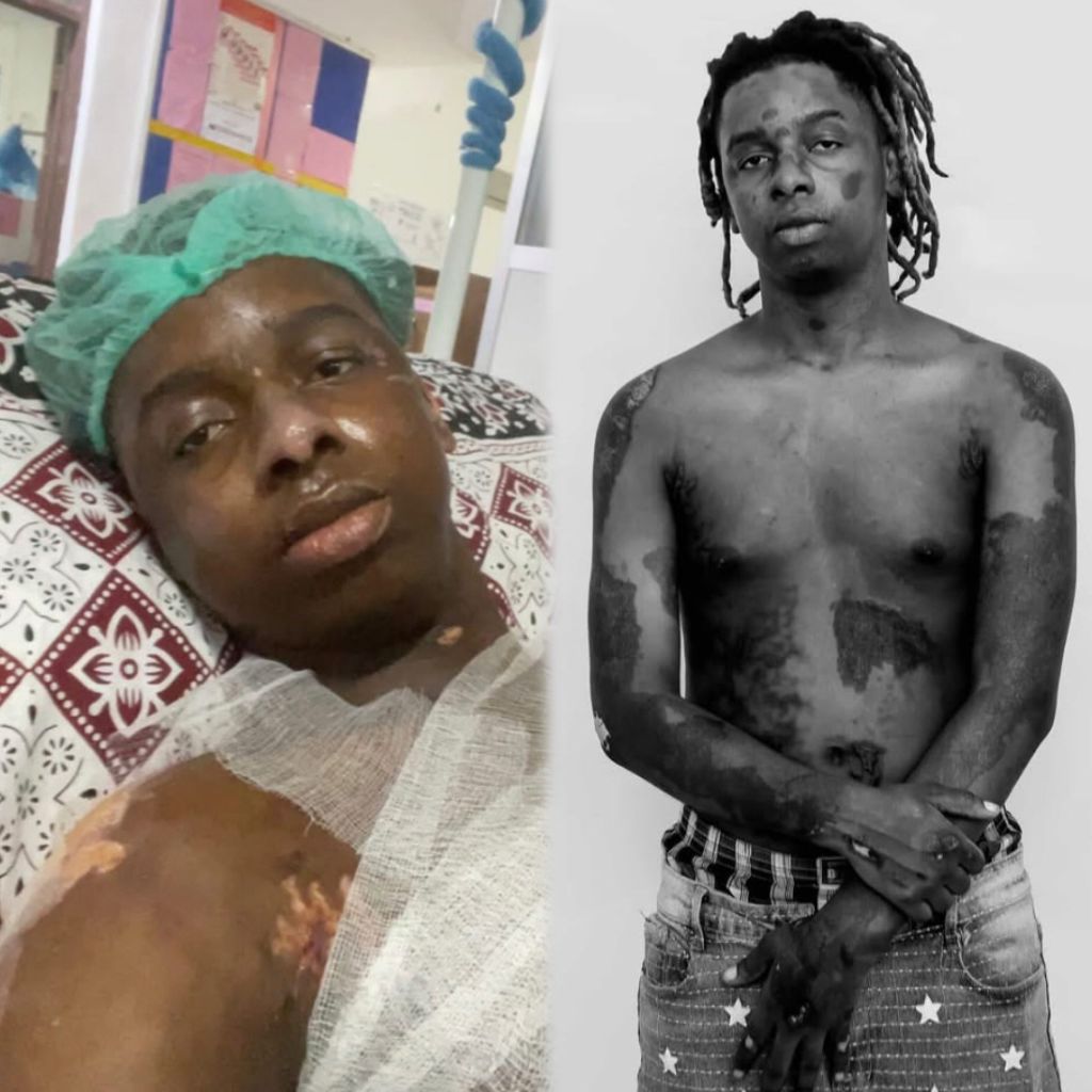 Mushizo Afunguka A – Z Ajali ya Moto, Aamini Uchawi