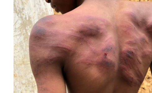 Wizara Kuchunguza Mwanafunzi Kupigwa na Mwalimu