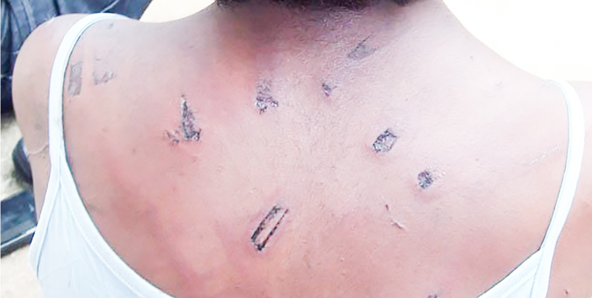 Waandishi Wanolewa Matukio ya Ukatili